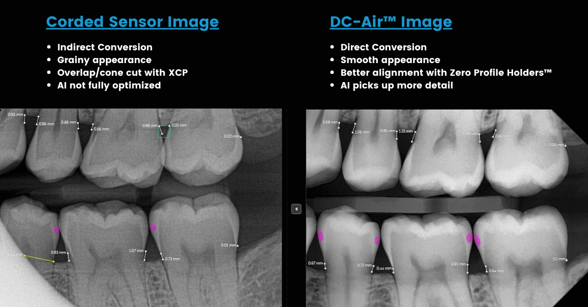 DC-Air wireless sensor compared with conventional corded sensors