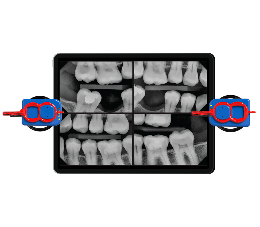 Dental Sensor Specifications  DC-Air™ Dental X-ray Sensor